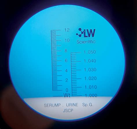 a refractomete reads 1.003 with distilled water|Urinalysis Ch 4 MC .